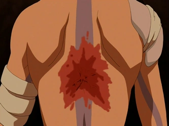 File:Aang's scar.png